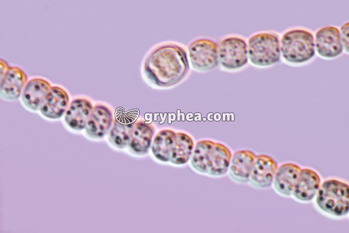 Nostocs - cyanobactéries observées au microscope x800 - gryphea.org